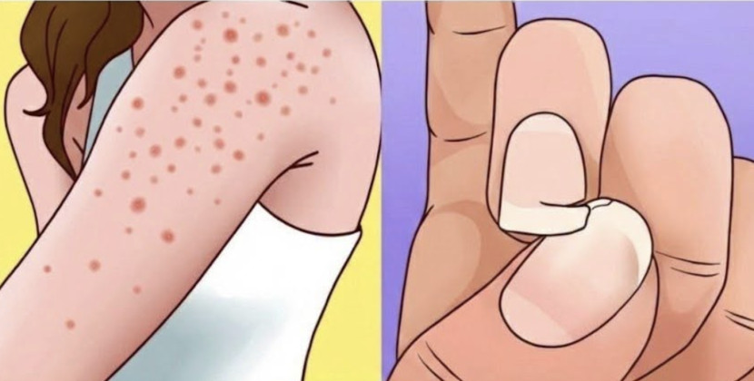 Simptomi koje ne treba ignorisati: Stručnjaci upozoravaju na moguće rane znakove ozbiljnih bolesti - featured image